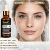 Teashell 5% Niacinamide Brightening Serum